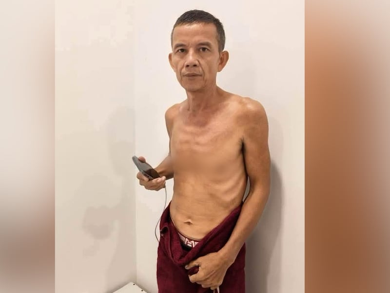 មន្ត្រីបក្សប្រឆាំងថា ភាពចង្អៀតណែន និងអាហារខ្វះជីវជាតិធ្វើឱ្យជាប់ឃុំស្គមស្គាំង